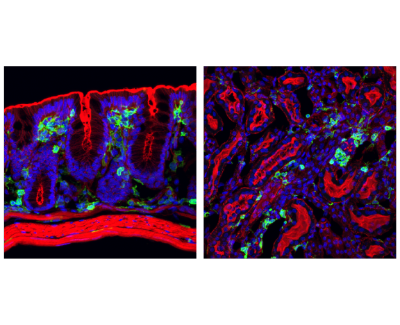 Immunofluorescence Image 3: CD45 (D3F8Q) Rabbit mAb (BSA and Azide Free)