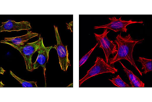 Immunofluorescence Image 1: Phospho-Myosin Light Chain 2 (Ser19) Mouse mAb