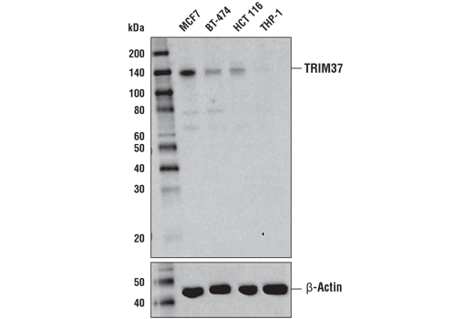 Western Blotting Image 1: TRIM37 (D7U2L) Rabbit mAb