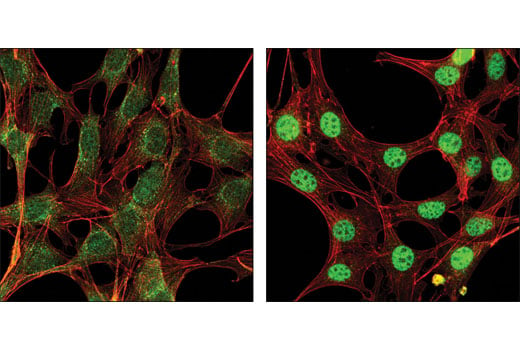 Immunofluorescence Image 1: Smad2 (D43B4) XP<sup>®</sup> Rabbit mAb (BSA and Azide Free)