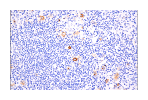 Immunohistochemistry Image 1: TNFRSF8/CD30 (E7E4D) XP<sup>®</sup> Rabbit mAb (BSA and Azide Free)
