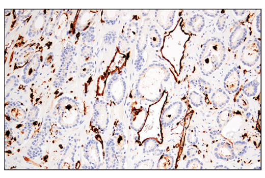 undefined Image 29: Late-Onset Alzheimer's Disease Risk Gene Antibody Sampler Kit