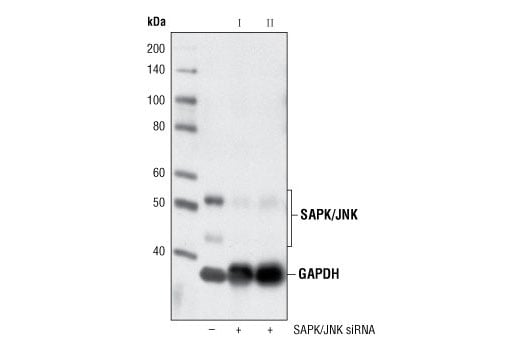 SignalSilence® SAPK/JNK siRNA I: Image 1