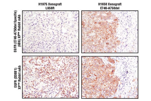 undefined Image 6: Lung Cancer RTK Antibody Sampler Kit