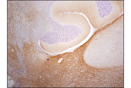 undefined Image 37: LRP1-mediated Endocytosis and Transmission of Tau Antibody Sampler Kit