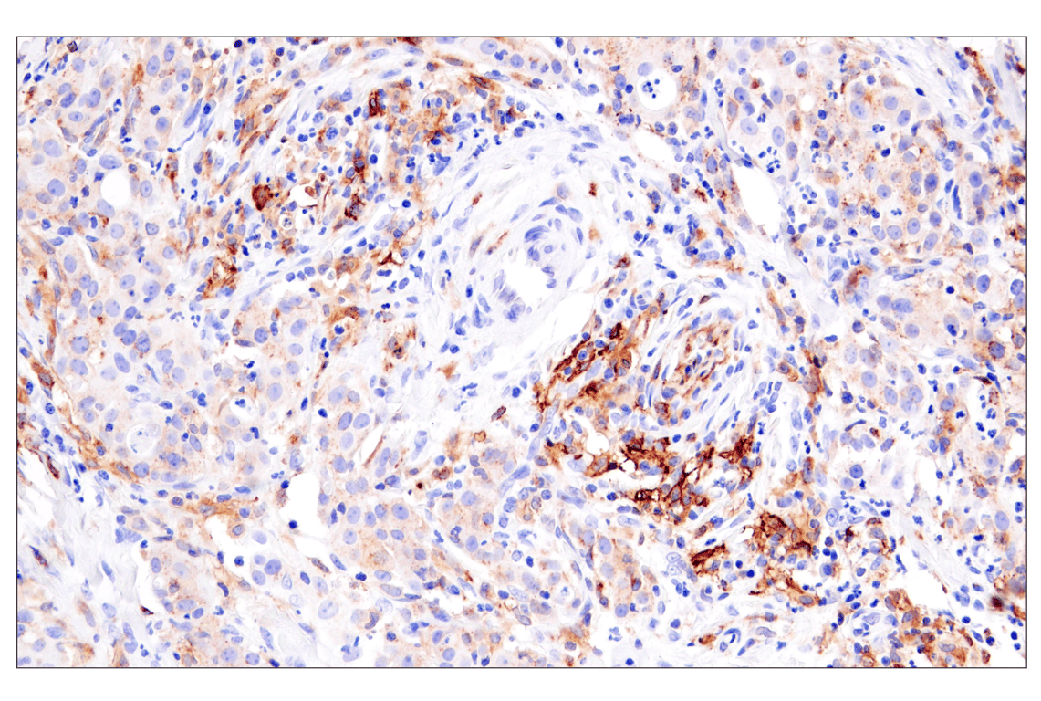 Immunohistochemistry Image 4: HLA-DRA (E9R2Q) XP<sup>®</sup> Rabbit mAb