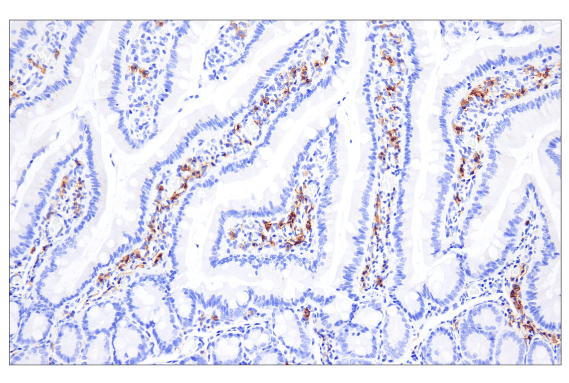 Immunohistochemistry Image 4: CD20 (E3N7O) XP<sup>®</sup> Rabbit mAb