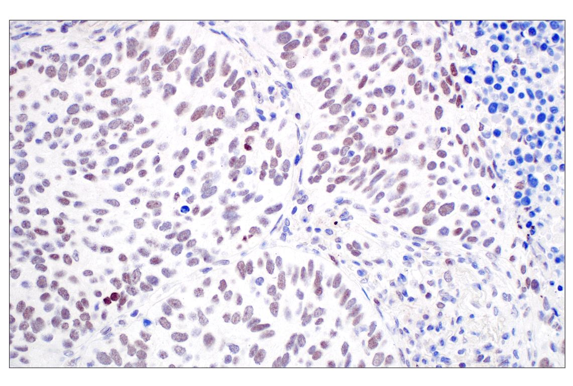 Immunohistochemistry Image 2: MDM2 (F7W7X) Rabbit mAb