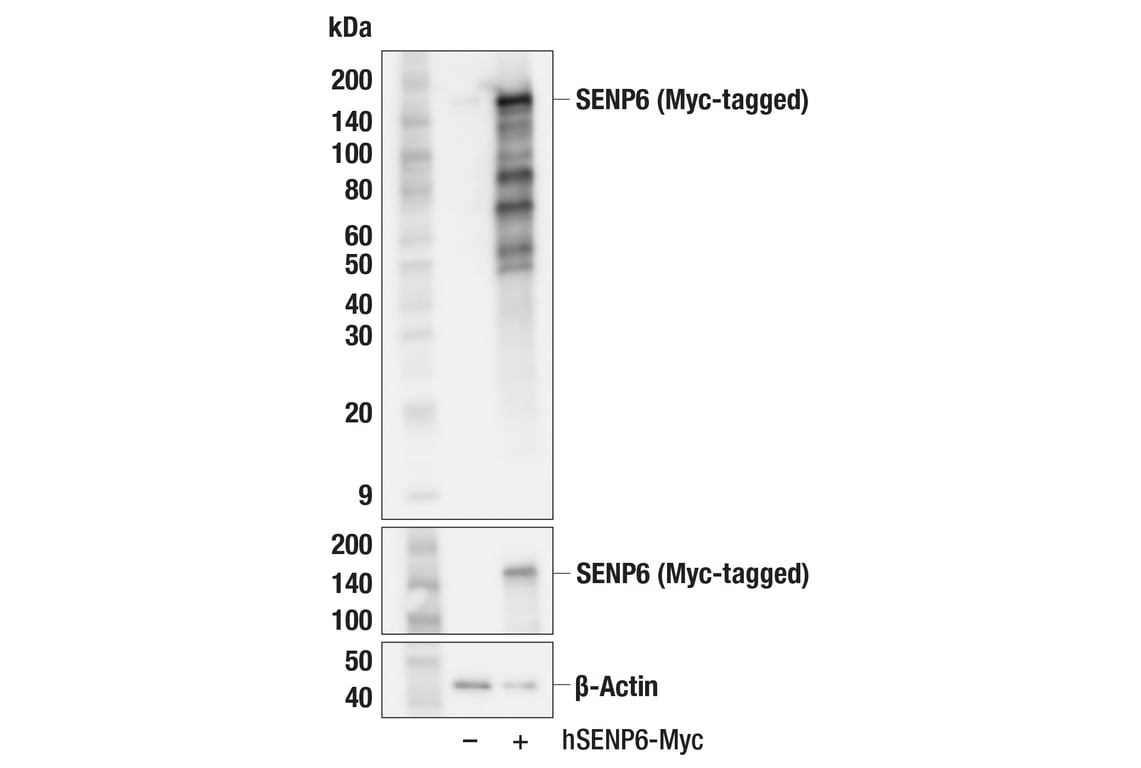 Western Blotting Image 2: SENP6 (F2K4K) Rabbit mAb