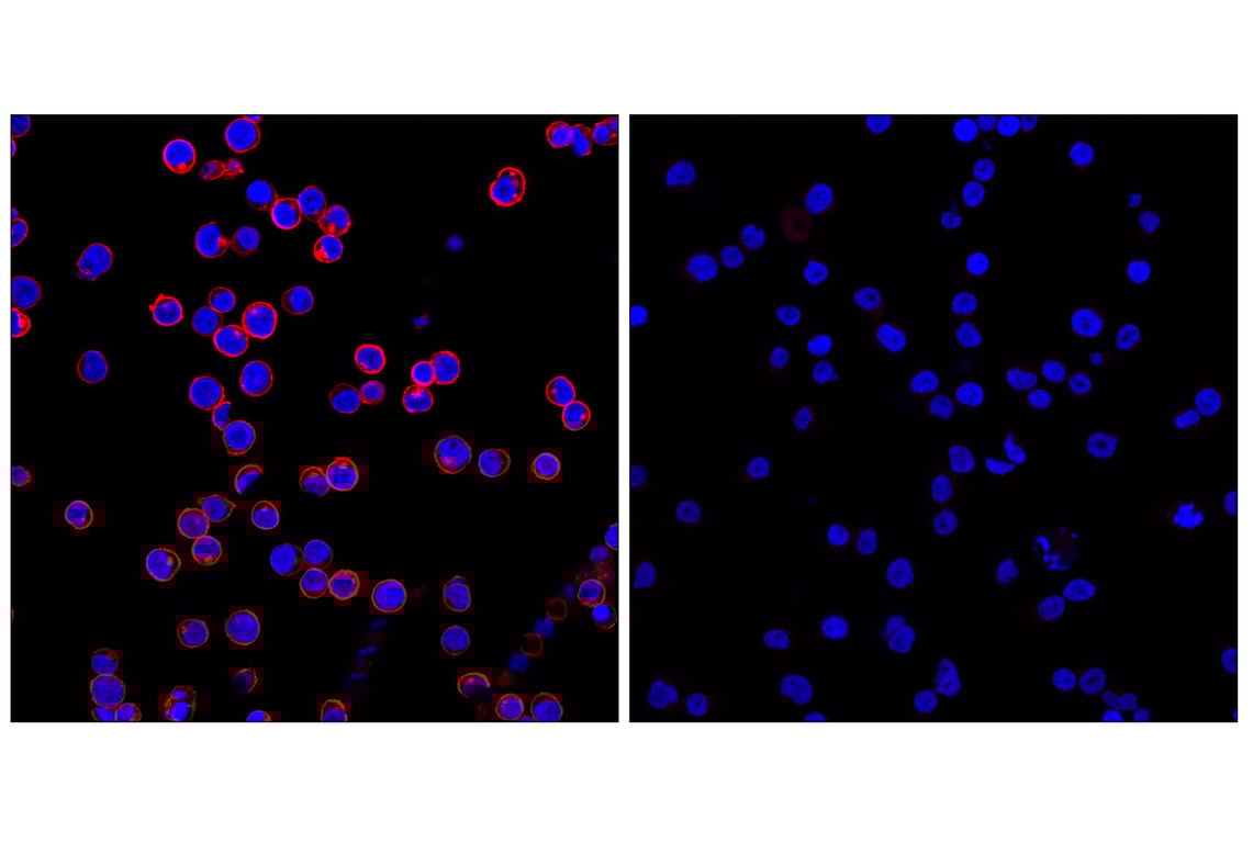 Immunofluorescence Image 1: CD45 (Intracellular Domain) (D9M8I) XP<sup>®</sup> Rabbit mAb (Alexa Fluor<sup>®</sup> 555 Conjugate)