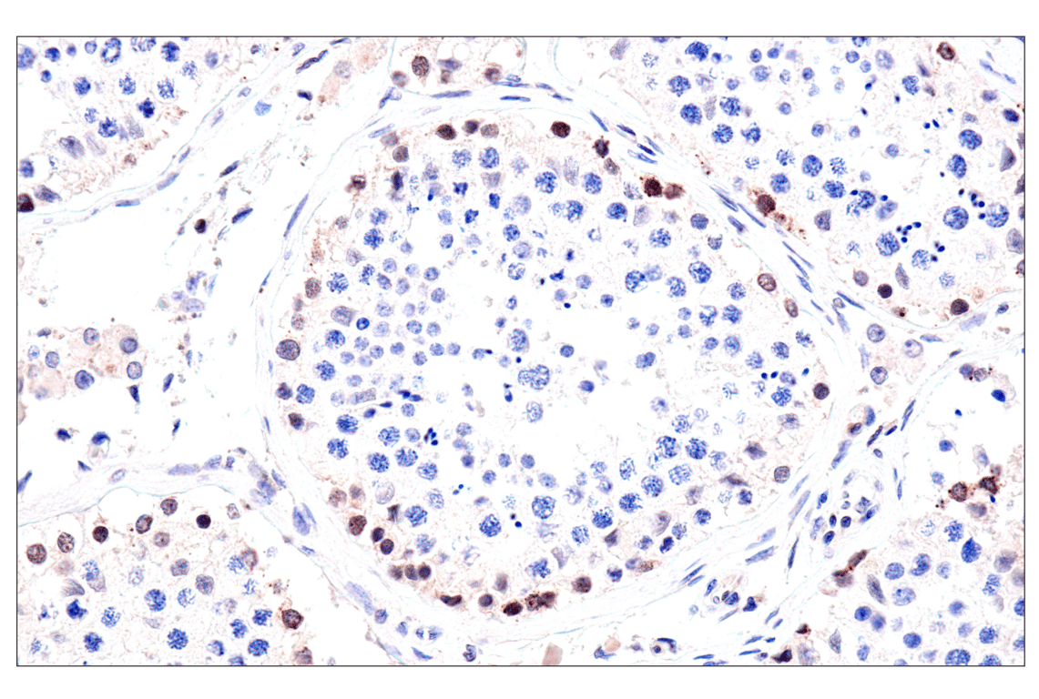 Immunohistochemistry Image 10: ADAR1 p150 Isoform   (E6U1U) Rabbit mAb   (BSA and Azide Free)