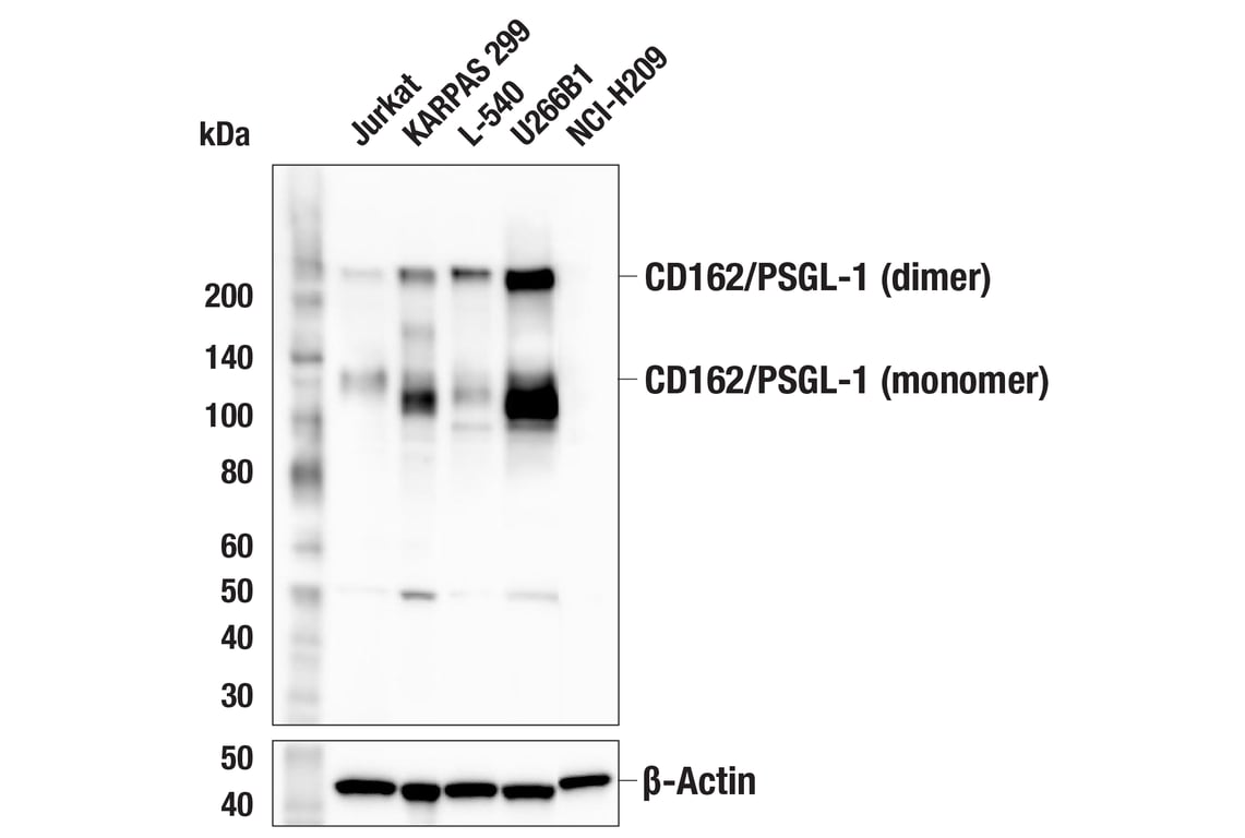 Western Blotting Image 1: CD162/PSGL-1 (F8D5X) Rabbit mAb