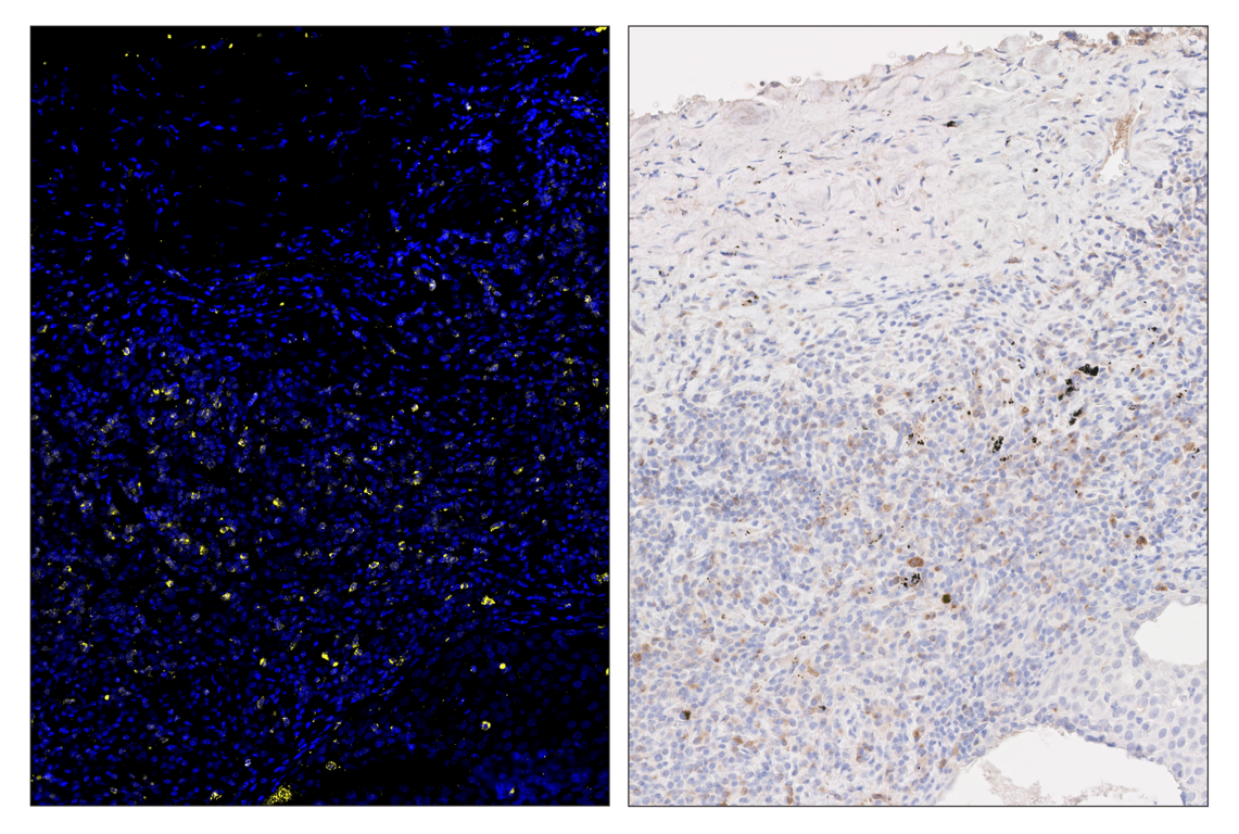 Immunohistochemistry Image 5: CTLA-4 (E2V1Z) & CO-0078-594 SignalStar<sup>™</sup> Oligo-Antibody Pair