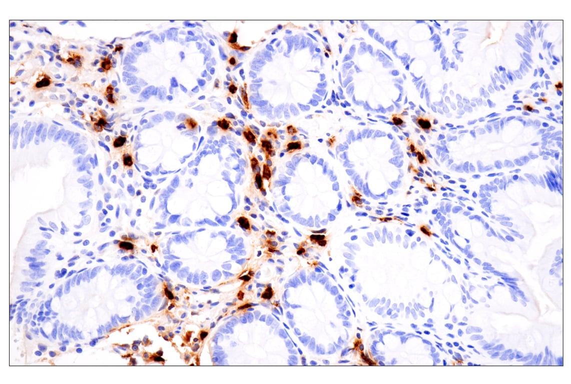 Immunohistochemistry Image 5: Neutrophil Elastase (F4H3X) Rabbit mAb (BSA and Azide Free)