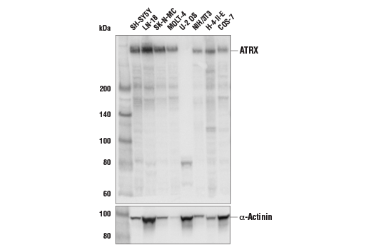 Western Blotting Image 1: ATRX (E5X7O) Rabbit mAb (BSA and Azide Free)