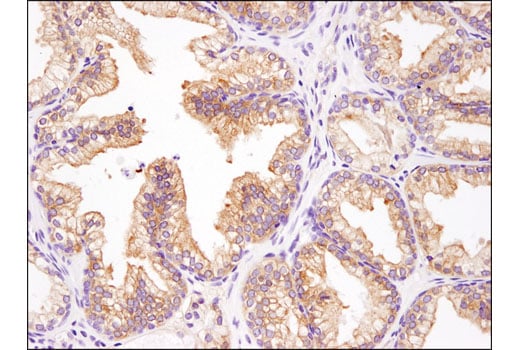 Immunohistochemistry Image 1: INPP4b (D9K1B) XP<sup>®</sup> Rabbit mAb