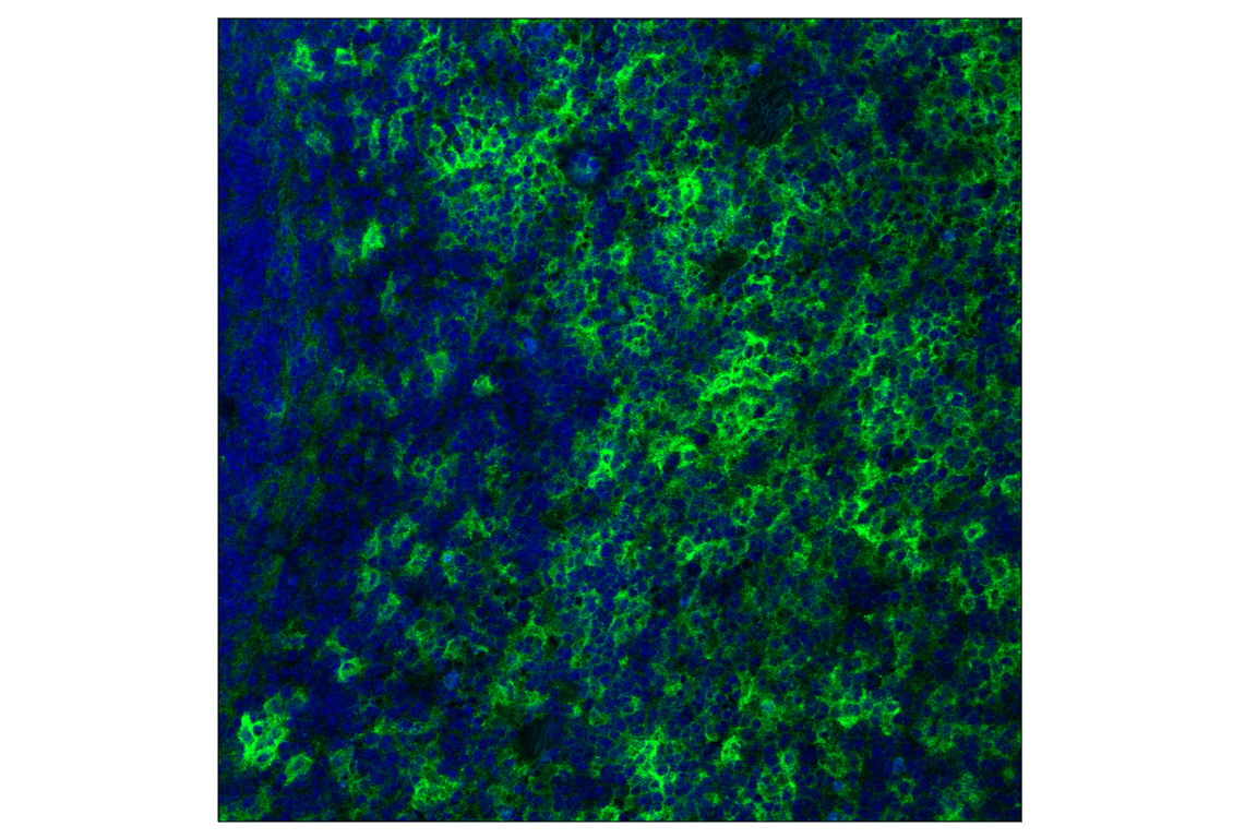 Immunofluorescence Image 3: CD14 (D1U2Y) Rabbit mAb