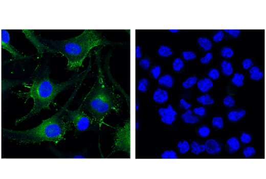 Immunofluorescence Image 1: Rab27A (D7Z9Q) Rabbit mAb (BSA and Azide Free)
