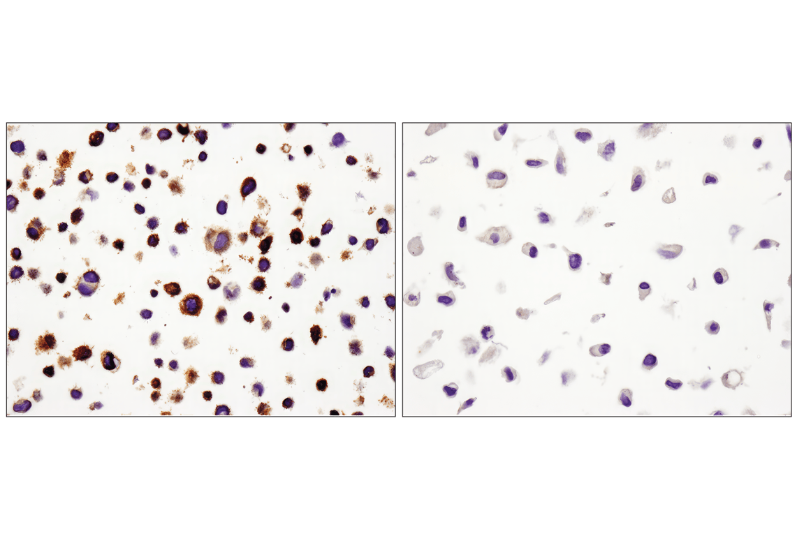 Immunohistochemistry Image 3: PD-L1 (E1L3N<sup>®</sup>) XP<sup>®</sup> Rabbit mAb (BSA and Azide Free)