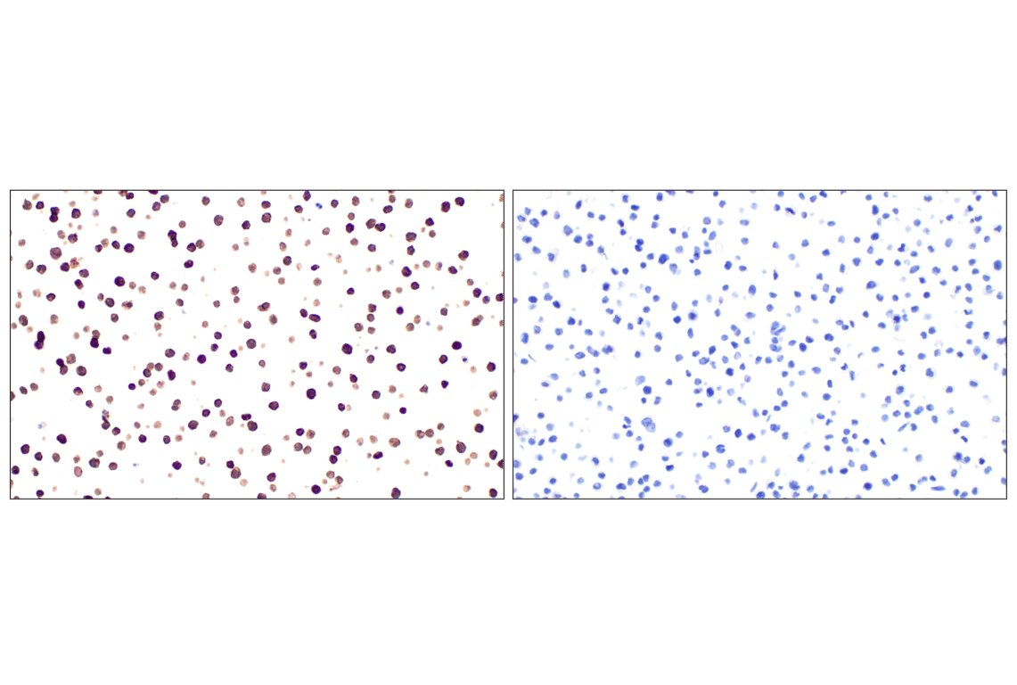 Immunohistochemistry Image 14: CD31 (PECAM-1) (F8M3S) Rabbit mAb (BSA and Azide Free)