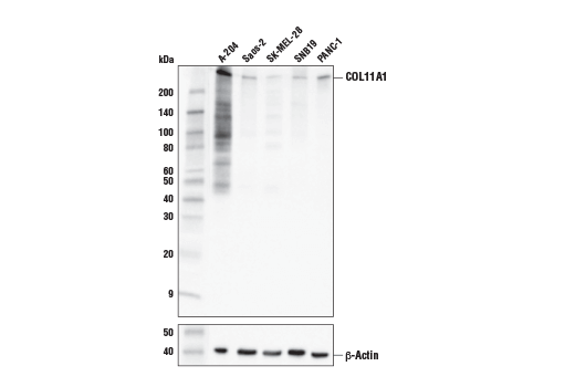 Western Blotting Image 1: COL11A1 (E6O7R) Rabbit mAb