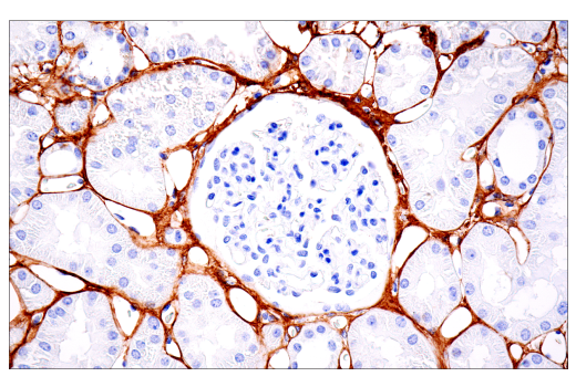 Immunohistochemistry Image 1: COL1A1 (E8F4L) XP<sup>®</sup> Rabbit mAb (BSA and Azide Free)