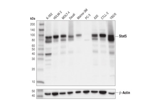 undefined Image 7: Stat3/Stat5 Signaling Antibody Sampler Kit