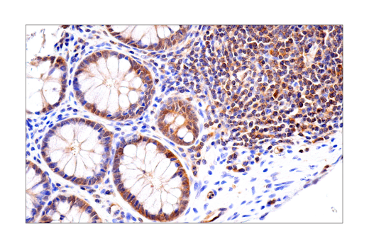 Immunohistochemistry Image 4: RIP3 (E7A7F) XP<sup>®</sup> Rabbit mAb