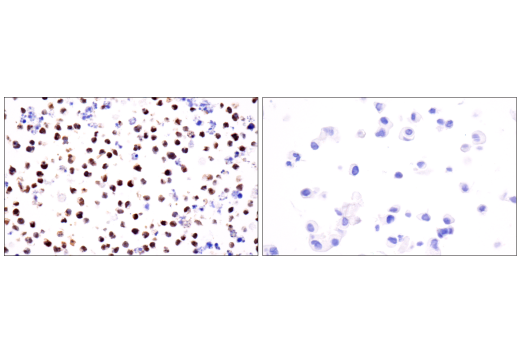 undefined Image 87: Human Exhausted CD8<sup>+</sup> T Cell IHC Antibody Sampler Kit