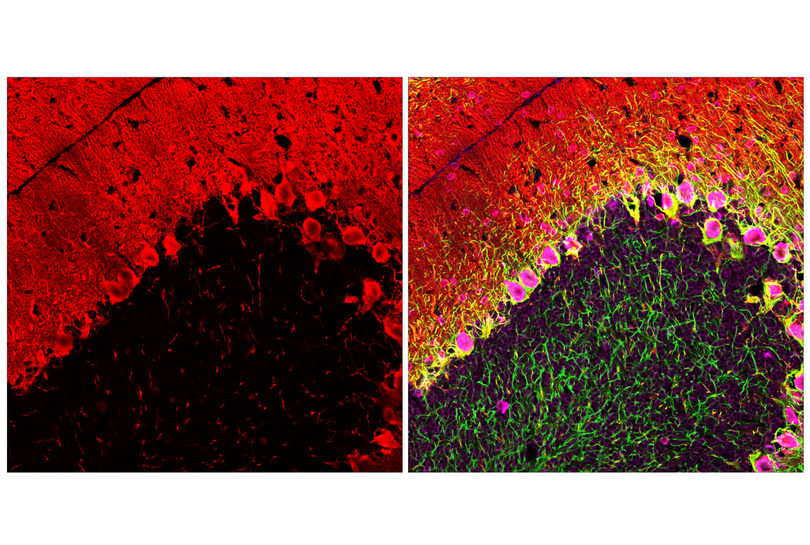 Immunofluorescence Image 1: Parvalbumin (E8N2U) XP<sup>®</sup> Rabbit mAb