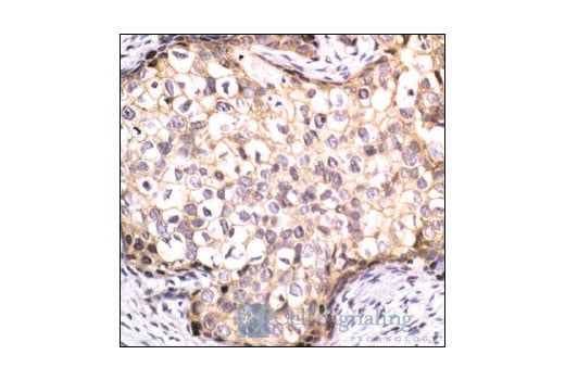 Immunohistochemistry Image 1: β-Catenin Antibody