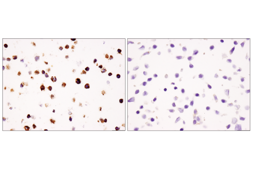 Immunohistochemistry Image 7: TIM-3 (D5D5R<sup>™</sup>) XP<sup>®</sup> Rabbit mAb (BSA and Azide Free)