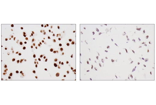 Immunohistochemistry Image 1: TRIM33 (D7U4F) Rabbit mAb