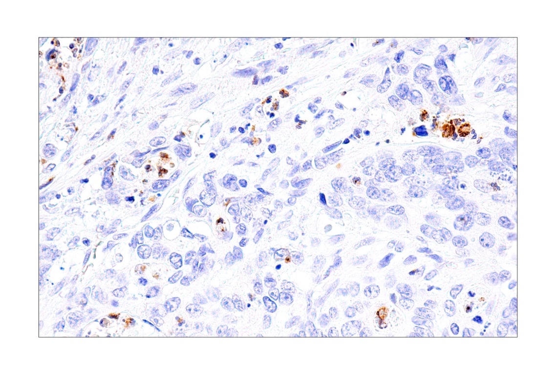 Immunohistochemistry Image 3: IL-8 (E5F5Q) XP<sup>®</sup> Rabbit mAb