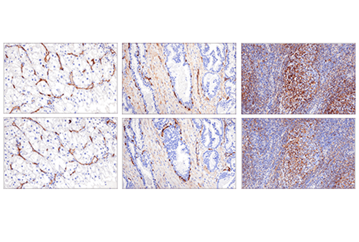 Immunohistochemistry Image 2: CD200 (E5I9V) XP<sup>®</sup> Rabbit mAb