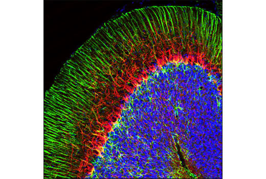 Immunofluorescence Image 1: Neurofilament-L (C28E10) Rabbit mAb (Alexa Fluor<sup>®</sup> 594 Conjugate)