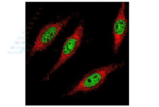 Immunofluorescence Image 1: Tri-Methyl-Histone H3 (Lys36) (D5A7) XP<sup>®</sup> Rabbit mAb