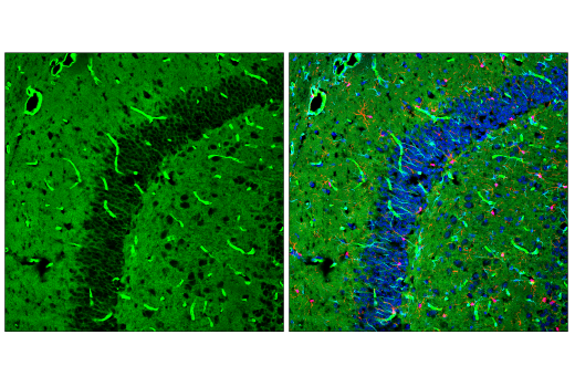 Immunofluorescence Image 1: Glut1 (E4S6I) Rabbit mAb