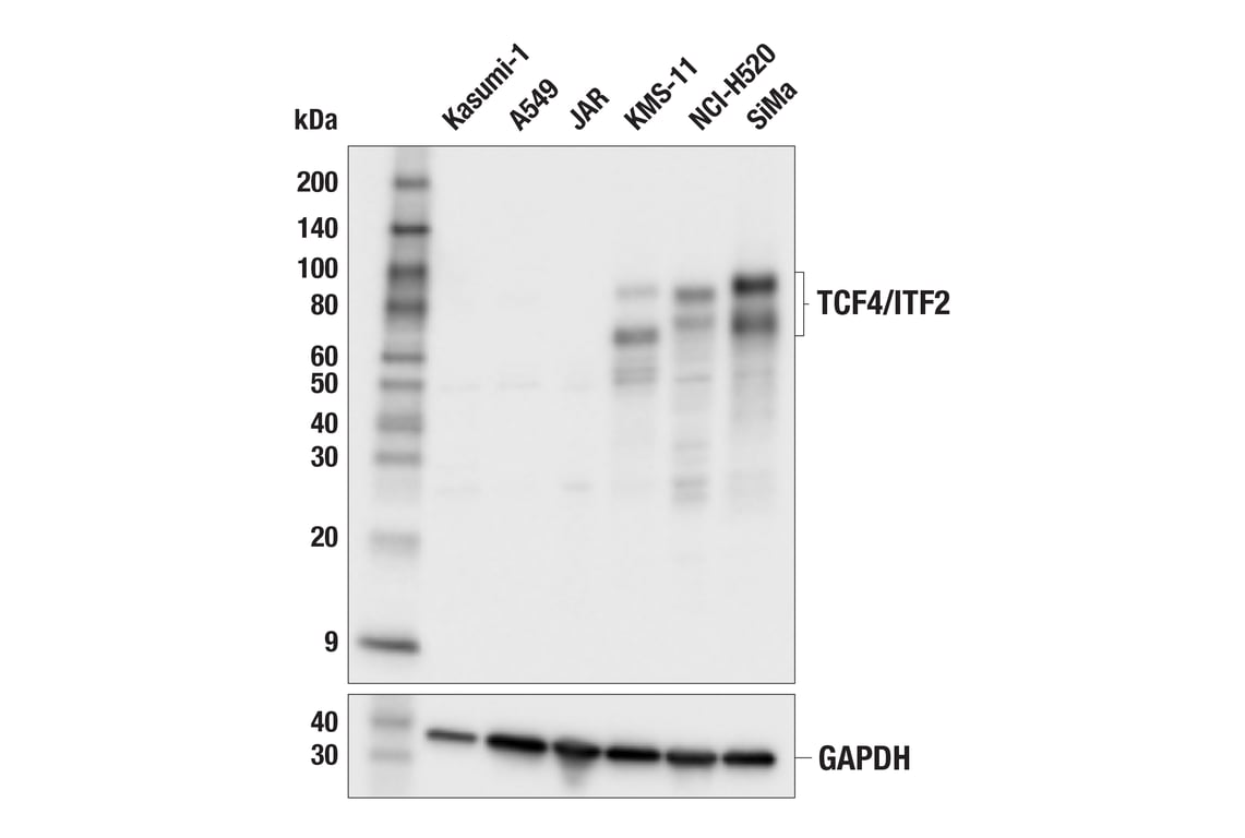 Western Blotting Image 1: TCF4/ITF2 (E3X2Y) Rabbit mAb