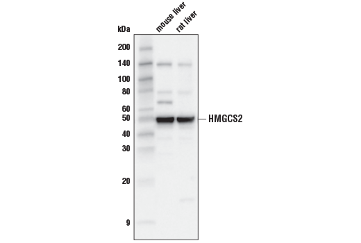 Western Blotting Image 2: HMGCS2 (D8B5M) Rabbit mAb