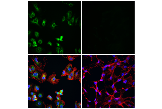 Immunofluorescence Image 1: p22phox (E7Y1F) XP<sup>®</sup> Rabbit mAb