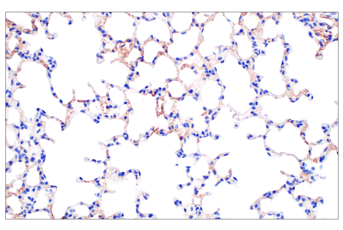 Immunohistochemistry Image 5: PNPLA3 (E7N6O) Rabbit mAb