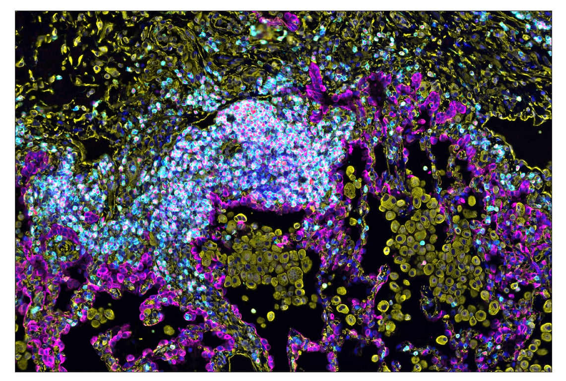 Immunohistochemistry Image 1: Vimentin (D21H3) & CO-0012-647 SignalStar<sup>™</sup> Oligo-Antibody Pair