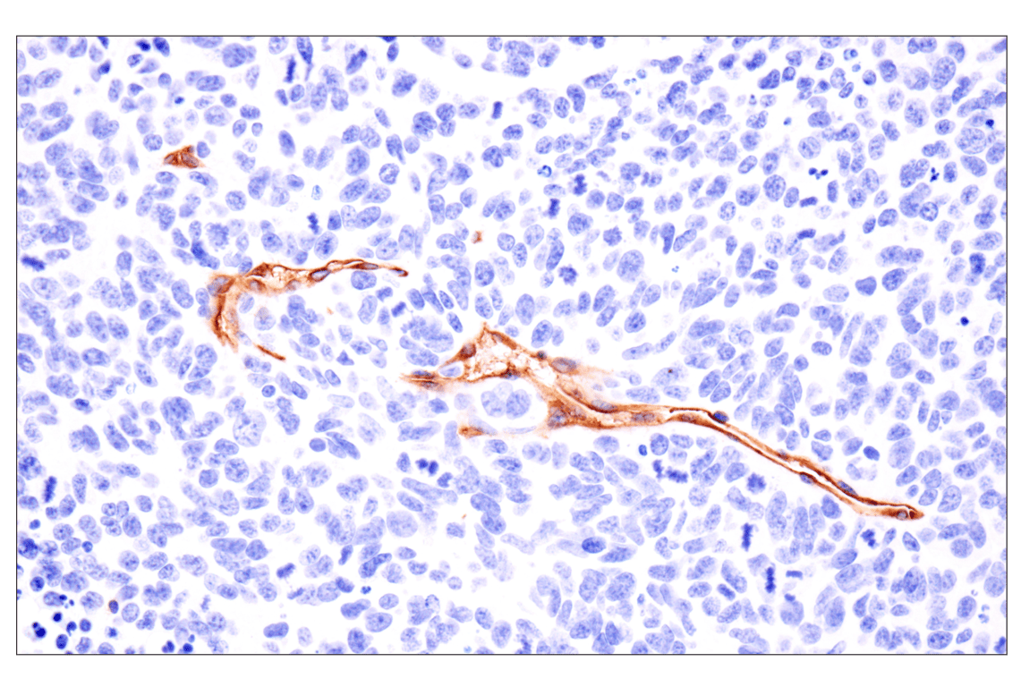 Immunohistochemistry Image 2: ESAM (F9D9P) Rabbit mAb