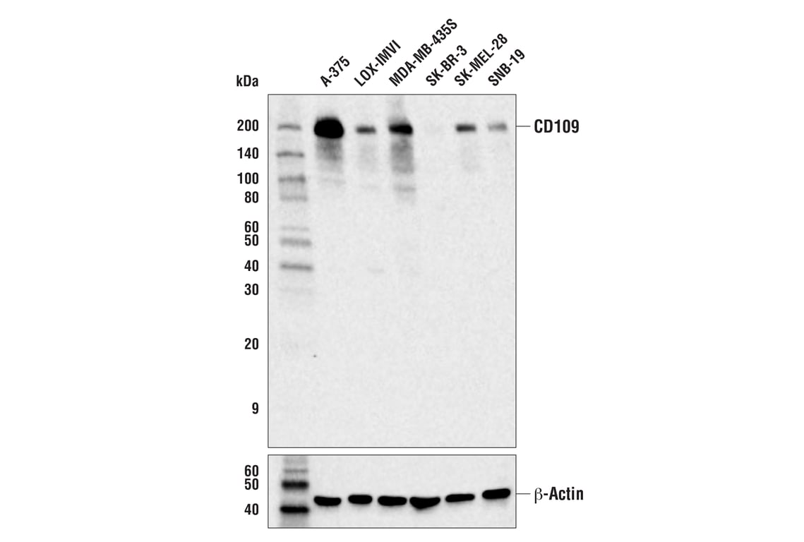 Western Blotting Image 1: CD109 (E8L2W) Rabbit mAb (Biotinylated)