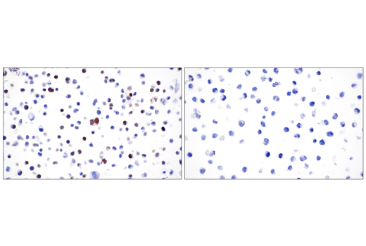 Immunohistochemistry Image 4: T-bet/TBX21 (D6N8B) XP<sup>®</sup> Rabbit mAb (BSA and Azide Free)