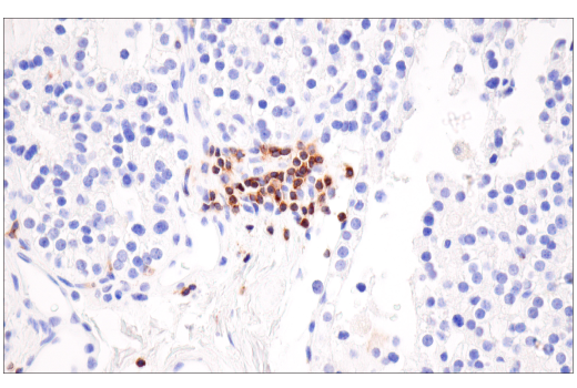 Immunohistochemistry Image 9: SLAMF6/CD352 (E3H1E) XP<sup>®</sup> Rabbit mAb