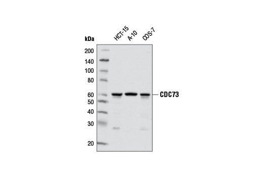 Western Blotting Image 1: CDC73 (D38E12) Rabbit mAb