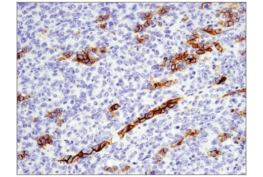 Immunohistochemistry Image 2: EpCAM (E6V8Y) XP<sup>®</sup> Rabbit mAb (BSA and Azide Free)