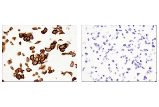 Immunohistochemistry Image 4: CD44 (E7K2Y) XP<sup>®</sup> Rabbit mAb